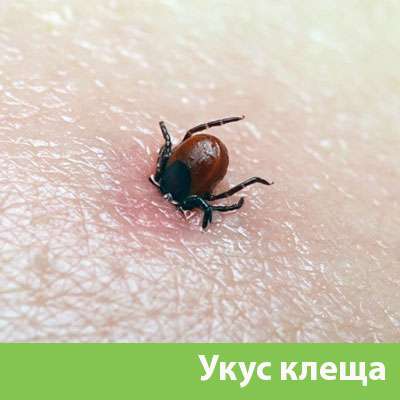 Укус клеща в Димитровграде